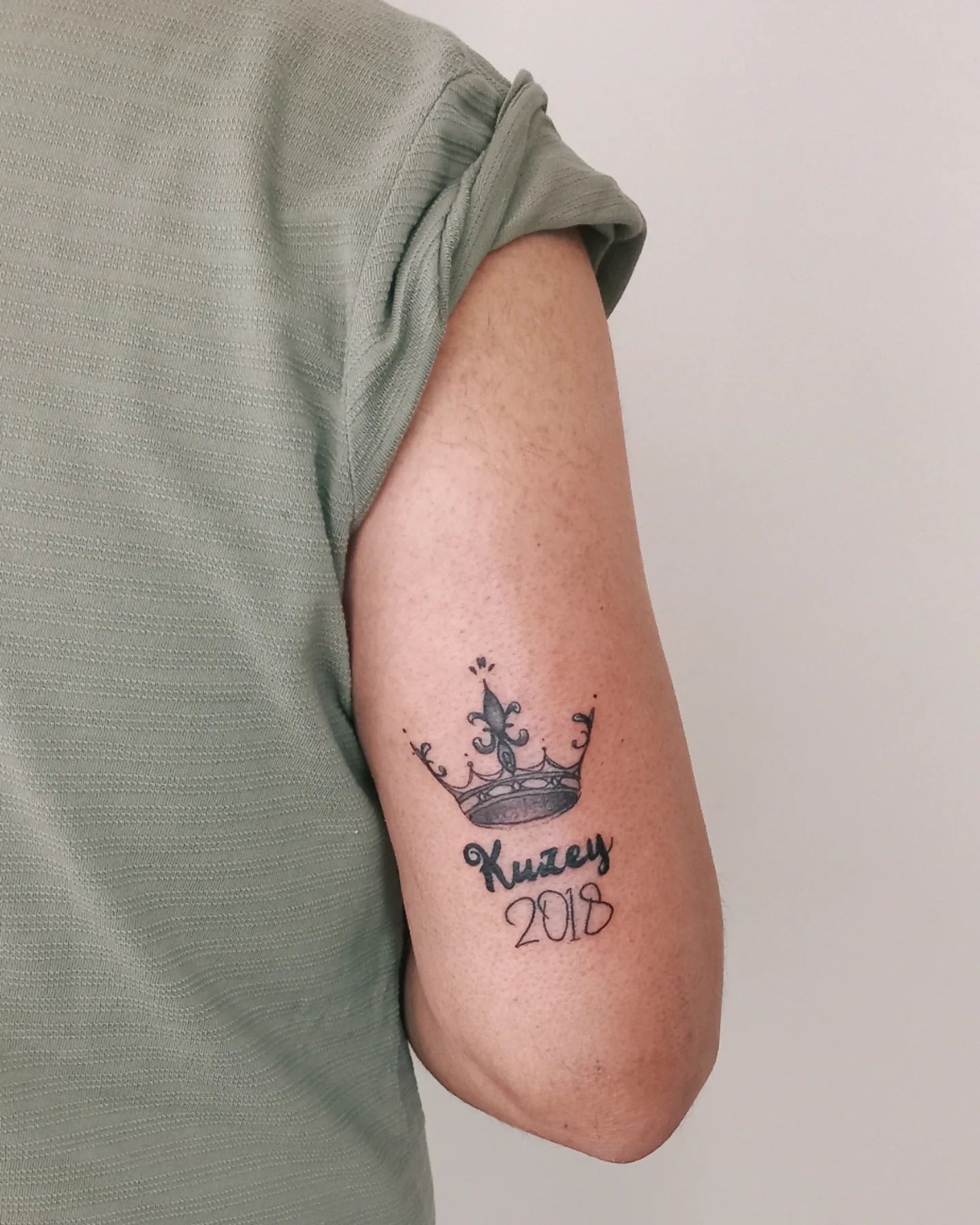 Diseño de corona en el brazo