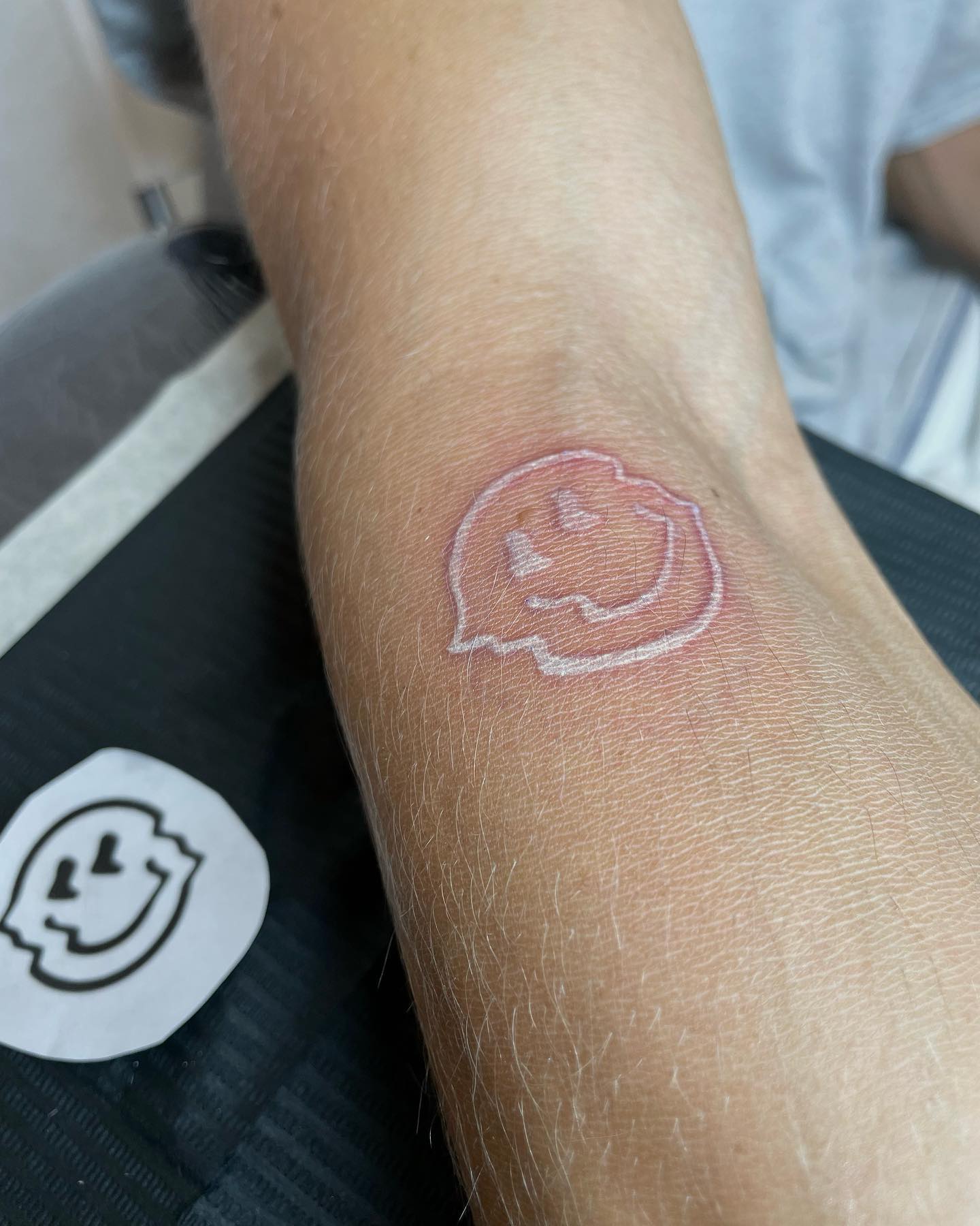 Tatuaje de cara sonriente con tinta blanca.