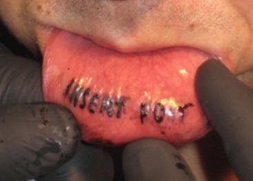 134-labio-inferior-tattoo
